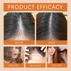 Image of Hair Regrowth Ampoules, Nourish The Scalp To Promote Germinal Nourish Hair Follicle Health Care Essence
