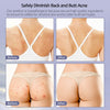 Image of Butt Acne Clearing Treatment, Maximum Strength Body Cream for Back, Buttocks,...