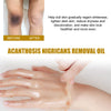 Image of Acanthosis Nigricans Removal Oil, Exfoliating Light Black Brightening And Beauty Skin Oil