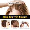 Image of HOEGOA Hair Growth Serum, Dense Hair Repair Dry And Irritated Hair Moisturizing Hair Dense Hair Care Essential Oil