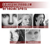 Image of Advanced Brightening and Exfoliating Facial Cream for Spot Lightening and Skin Repair