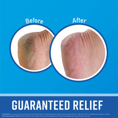 Healthy Feet Foot Cream - Effective Relief for Extremely Dry, Cracked Feet - Instant Moisture Boost - 3.2 Ounce Jar (Pack of 3)