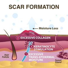 Xeragel 100% Silicone Scar Treatment Ointment - Clinically Proven Efficacy in Scar Reduction