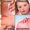 Image of Hydrocortisone Cream for Eczema Relief with Aloe Vera - 80g
