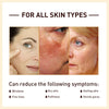 Image of Rice Anti Wrinkle Essence, Repairs Skin Moisturizes Firms Whitens Essence