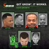 Image of GROW Maximum XXL Beard and Mustache Growth Accelerator Serum Oil - Premier Formula