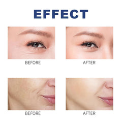 Collagen Face Mask Set - 5 Pack Deep Hydrating Overnight Treatment for Anti-Aging, Firming, and Moisturizing - 1 Fl. Oz Each