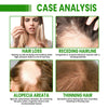 Image of Hair Root Spray, Repair Dry Hair Fickle Hair Tight Hair To Prevent Smooth Hair