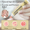 Image of Moisturizing Face and Body Cream for Dry Skin and Psoriasis Relief with Natural Ingredients - 20g