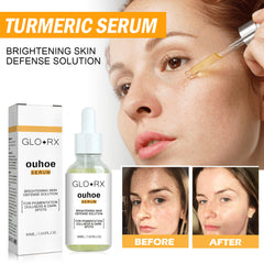 Turmeric Whitening Spot Serum, Lighten Freckle Spots Brightening Skin Hydrating Serum