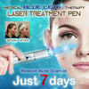 Image of Eraser Blue Light Therapy Wrinkle Acne Laser Pen Soft Scar Removal