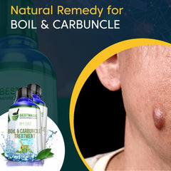 Maximum Strength Natural Drops for Effective Boil Relief