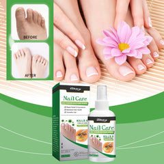 South Moon Nail Care Spray, Gentle Odor Relief Repair Nail Shine Essence Spray