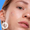 Image of Acne Cover Patches, FSA HSA Eligible Hydrocolloid Pimple Patches for Face with Tea Tree Oil, Korean Skincare Zit Patches for Face | FSA HSA Store Eligible Items | Vegan, Cruelty-Free