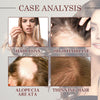Image of Coconut Hair Essential Oil, Moisturizes Tightens And Strengthens Hair Scalp Massage Essential Oil