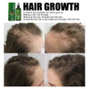 Image of Hair Care Solution Gently Nourishes And Massages Scalp, Moisturizes And Softens Hair Care Spray