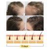 Image of Ginger Dense Hair Soap, Moisturizes Hair Ends And Roots Cleansing Scalp Hair Care Shampoo Soap