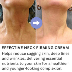 Neck Firming and Lifting Cream for Anti-Aging and Wrinkle Reduction