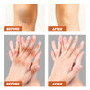 Image of Black Wattle Essential Oil, Repair Underarm Joint Black Whitening Skin Light Spots Skin Beauty Essence Oil