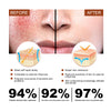 Image of Erythematous Repair Essence, Repair Skin Lighten Facial Erythematous Moisturizing Essential Oil