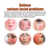 Image of Erythematous Repair Essence, Repair Skin Lighten Facial Erythematous Moisturizing Essential Oil