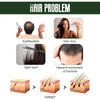 Image of Ginger Dense Hair Spray Nourishes Hair Follicles, Prevents Hair Loss And Breaks, Moisturizes And Thickens Hair Spray