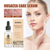 Image of Erythematous Repair Essence, Repair Skin Lighten Facial Erythematous Moisturizing Essential Oil