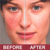 Image of Hydrocortisone Cream for Eczema Relief with Aloe Vera - 80g