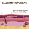 Image of Xeragel 100% Silicone Scar Treatment Ointment - Clinically Proven Efficacy in Scar Reduction