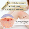 Image of Moisturizing Face and Body Cream for Dry Skin and Psoriasis Relief with Natural Ingredients - 20g