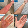 Image of Grahams Natural Eczema Cream 176 Ounce Natural Skin Moisturizer for Itchy Skin