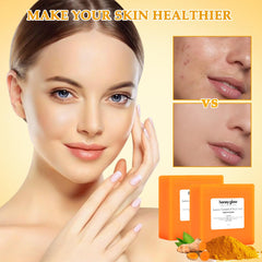 Honey Glow Lemon Turmeric Kojic Soap Bar - 2 Pack, Natural Handmade Turmeric Soap for Face and Body, Suitable for All Skin Types, Promotes Smooth Skin