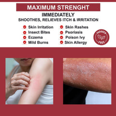Hydrocortisone Cream for Eczema Relief with Aloe Vera - 80g