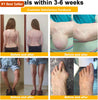 Image of Bee Venom Therapeutic Cream for Pain Relief and Bone Healing in Arthritis