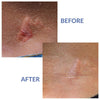 Image of Xeragel 100% Silicone Scar Treatment Ointment - Clinically Proven Efficacy in Scar Reduction