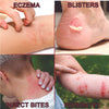 Image of Hydrocortisone Cream for Eczema Relief with Aloe Vera - 80g