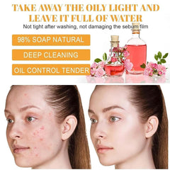 Hoygi Glow Wash Turmeric Face Wash with Brush - Deep Cleansing Exfoliating Facial Scrub for All Skin Types