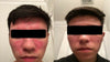 Image of Seborrheic Dermatitis Relief Face Cream with MCT Oil and Squalane