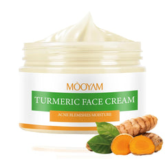 Turmeric Face Cream for Acne and Blemish Treatment - Organic Moisturizer for Skin Care (50G) - Ideal Christmas Gift