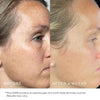 Image of Beauty TBT Cream - Lightweight Anti-Aging Retinol Alternative and Moisturizer with Bakuchiol, 1.7 Oz / 50 Ml